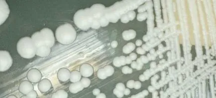 Kezelése candidiasis nők - gyógyszerek