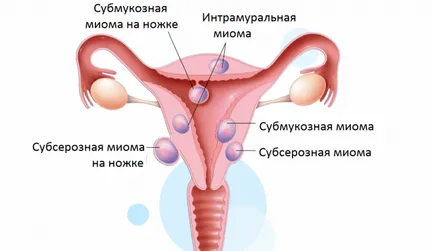 Havi hónapban az oka, hogy a gyártmány (hónap) Havi hónapban az oka, hogy győződjön