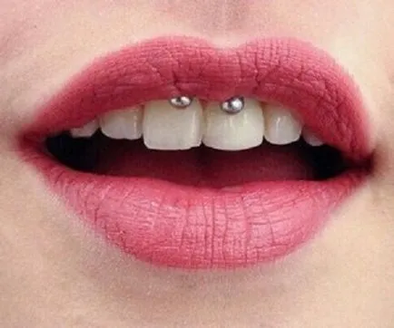 Piercing smiley - fotók, fájdalom, következmények, kockázatok, ár