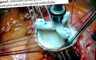 nélküli