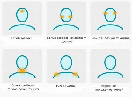 Következményei malocclusion felnőtteknél, mint gyermekeknél fenyeget figyelmen kívül hagyja a probléma (a következményeit malocclusion felnőtteknél) Következményei malocclusion felnőtteknél, mint gyermekeknél fenyeget hogy figyelmen kívül hagyja a problémát