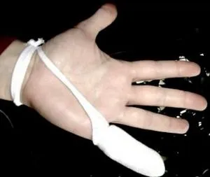 Törött ujj a kezét fájdalom nélkül, fájó ujjakkal