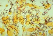 Treponema pallidum - az