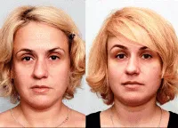 dekorációs szemöldök