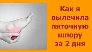 Az összeesküvések és imák sarkantyú (parcellák) Az összeesküvések és imák sarokcsontsarkantyú