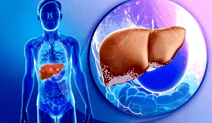 keto