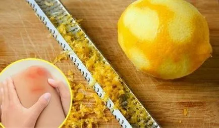 Eszközök a striák Eszközök a striák