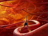 Atherosclerosis az aorta hogy