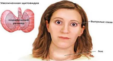 Vér vizsgálati pajzsmirigy Vér vizsgálati pajzsmirigy