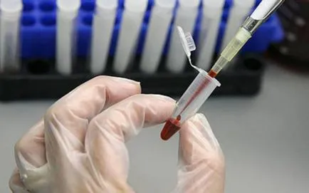 Biokémiai vérvizsgálat a kutyák Biokémiai vérvizsgálat a kutyák