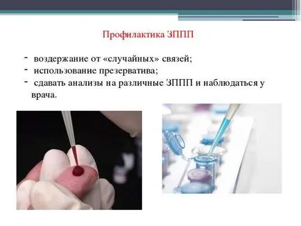 Hogyan lehet tesztelni STD Hogyan lehet tesztelni STD