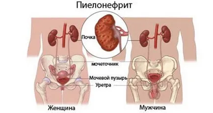 Vese kezelés gyermekeknél Vese kezelés gyermekeknél
