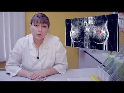 Hogyan kell szedni a bürök