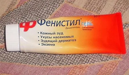 Ez enyhíti a viszketést a szúnyogcsípés