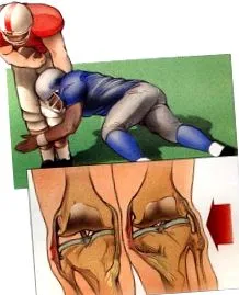 язок