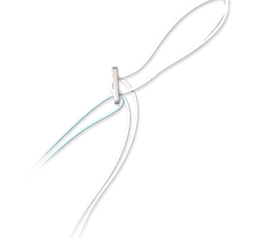 ligamentoplastia