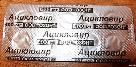 Herpes zoster kezelésére