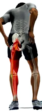 intervertebrális lemezek