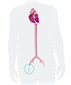 aorta aorta