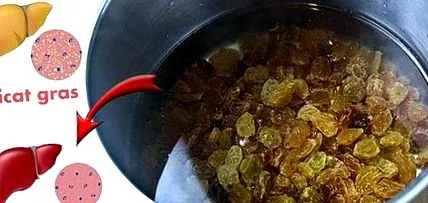 ételek zsírmájbetegségben