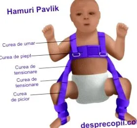 дислокација