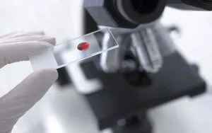 Hogyan kell átadni a vizsgálatokat a pajzsmirigy Hogyan kell átadni a vizsgálatokat a pajzsmirigy