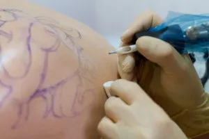 Hogyan lehet csökkenteni a tetoválás Hogyan lehet csökkenteni a tetoválás