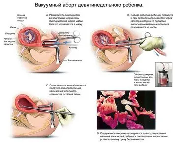 Hogyan ölnek gyerekeket Hogyan ölnek gyerekeket