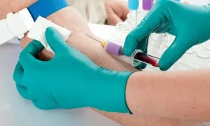 Hogyan lehet gyógyítani élesztő fertőzés a férfiaknál
