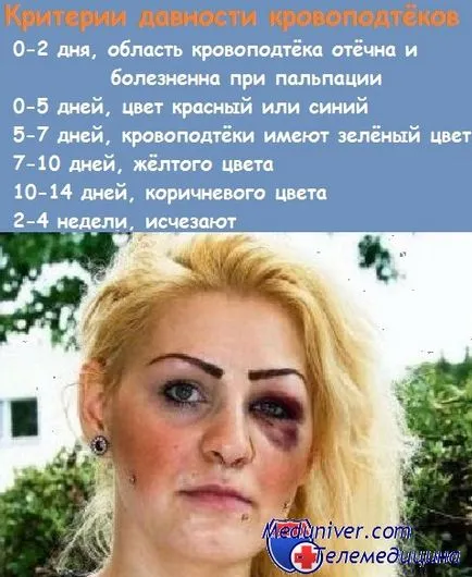 Hogyan lehet elrejteni egy fekete szeme