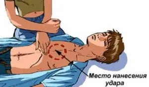 Hogyan javítsam szívmasszázst Hogyan javítsam szívmasszázst