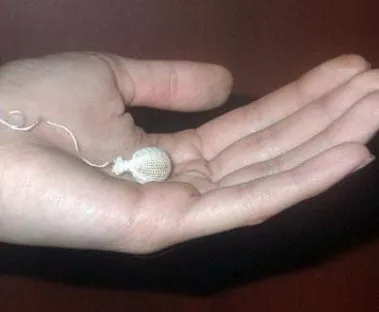 Kínai tamponok kezelés Kínai tamponok kezelés