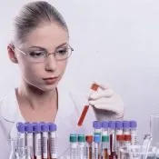 Vér vizsgálati pajzsmirigy Vér vizsgálati pajzsmirigy