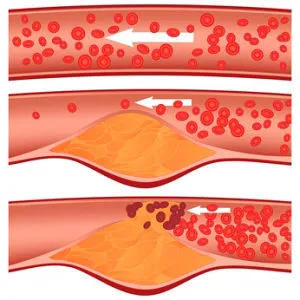rosacea kozmetikumok rosacea kozmetikumok