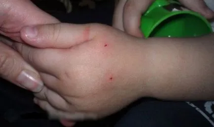 Ha megharapott egy macska