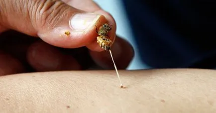 Előnyök és kezelés Előnyök és kezelés