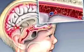 súlyos okai