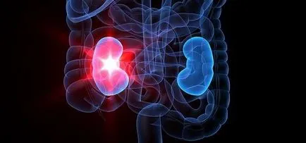 Hogyan és mit idült pyelonephritis