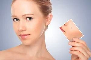 Whitening krém Whitening krém