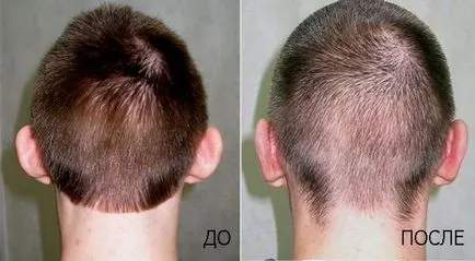 Hogyan műanyag