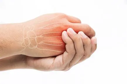 Mik a jelei osteochondrosis