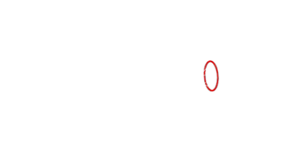 rövidlátás