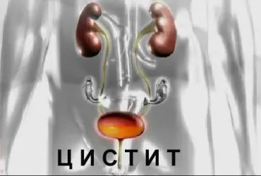 Ezért cystitis
