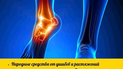 Mi segít a zúzódások