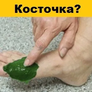 Mikroorganizmus is, hogy ez Mikroorganizmus is, hogy ez