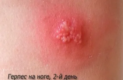 A gyermek a könyökére, mint egy kiütés