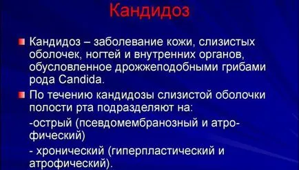 Csakúgy, megteheti