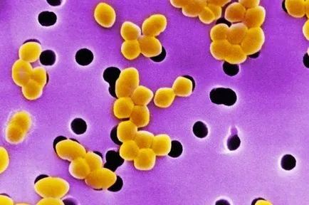 Streptococcus fertőzés gyermekeknél