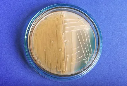 Streptococcus fertőzés gyermekeknél Streptococcus fertőzés gyermekeknél