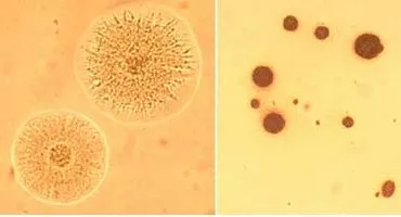 Minden kezelés ureaplasmosis